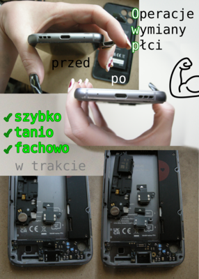 Operacje wymiany płci: ✅ szybko ✅ tanio ✅ fachowo